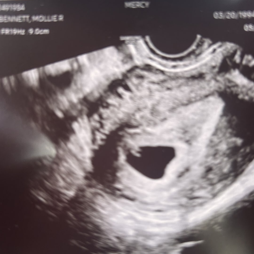 Photo shared by Mollie for their Babylist baby registry.