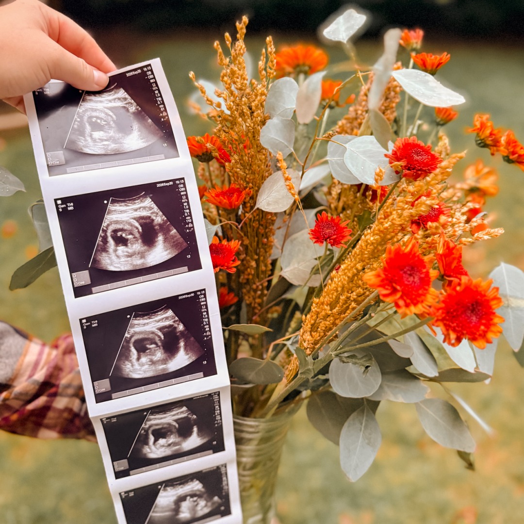 Photo shared by Grace for their Babylist baby registry.