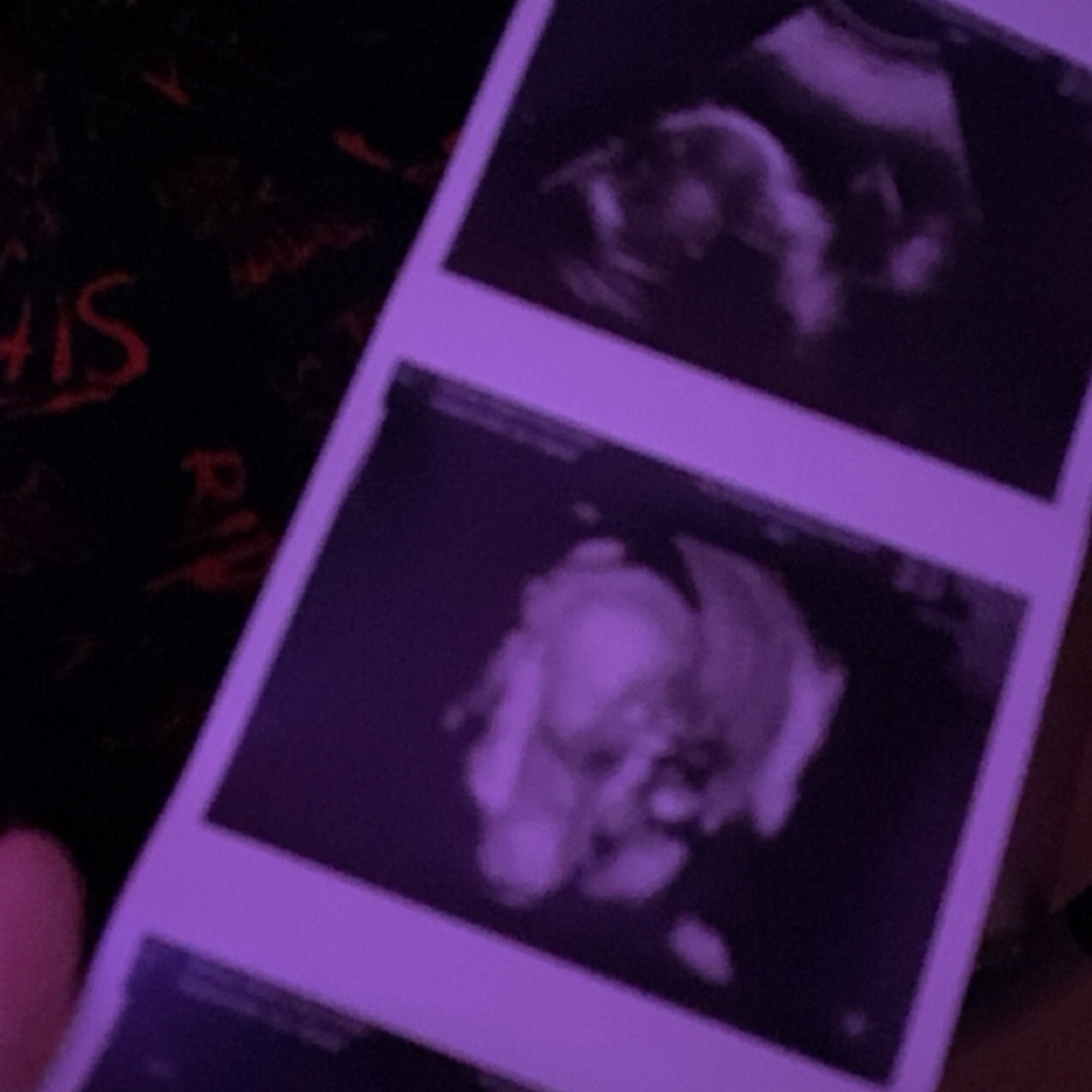 Photo shared by Alexis for their Babylist baby registry.