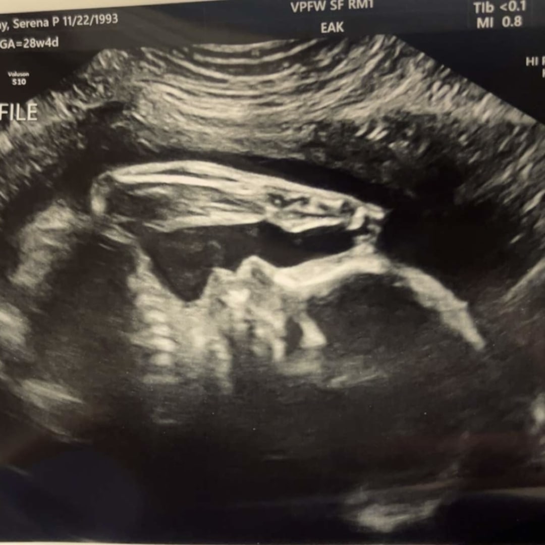 Photo shared by Serena for their Babylist baby registry.