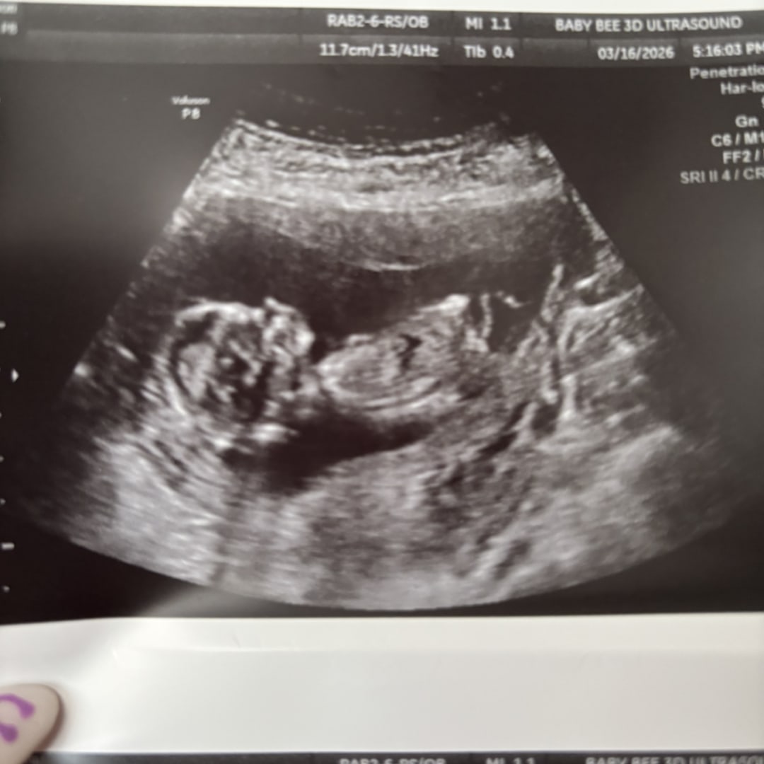 Photo shared by Ashley for their Babylist baby registry.