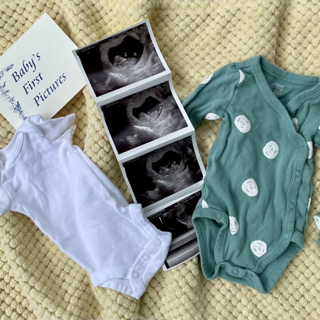 Photo shared by Shyann for their Babylist baby registry.