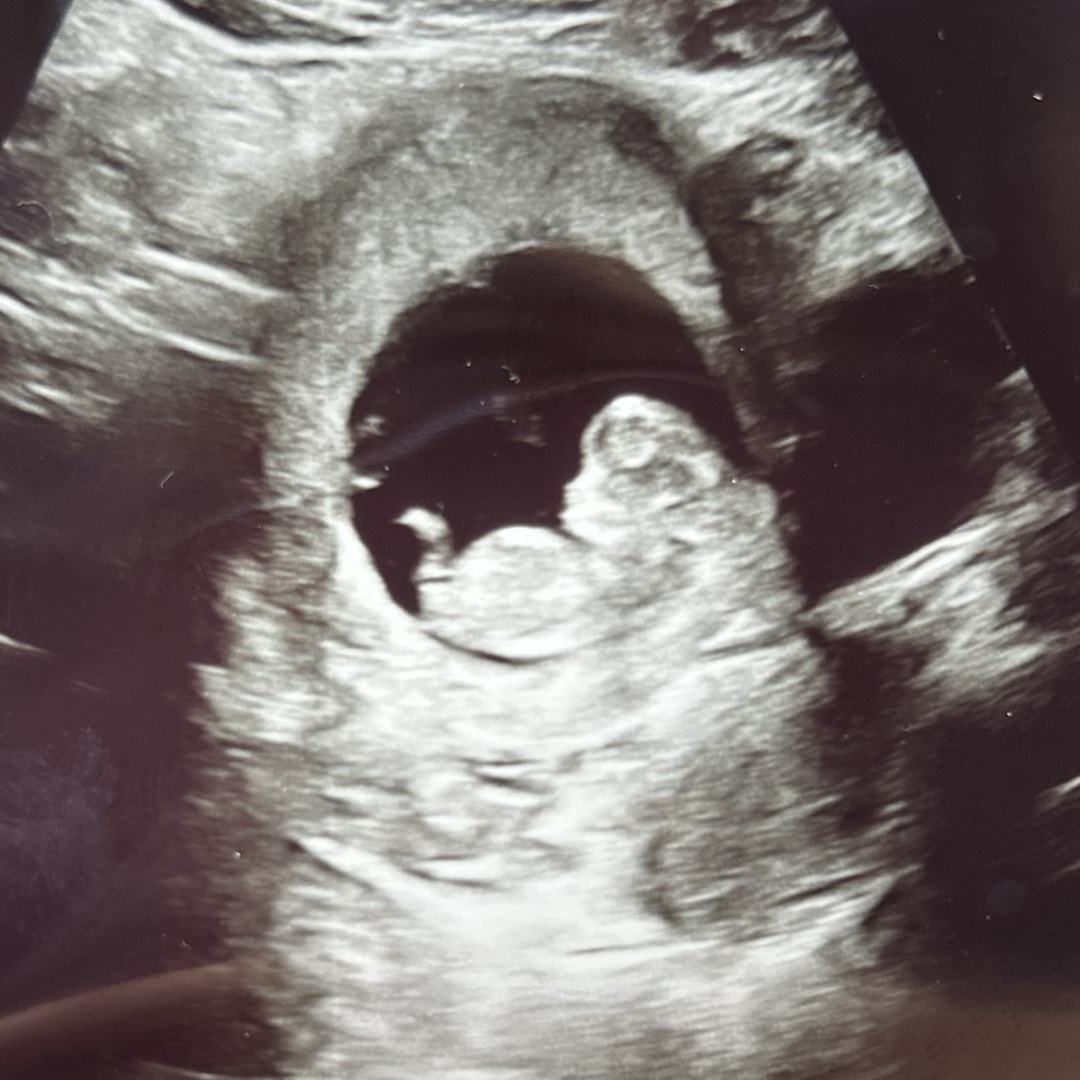 Photo shared by Emma for their Babylist baby registry.