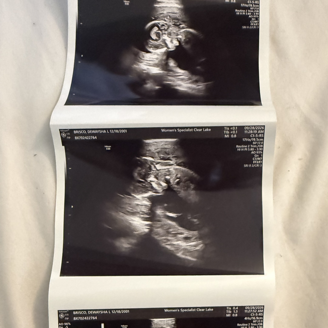 Photo shared by Dewaysha for their Babylist baby registry.