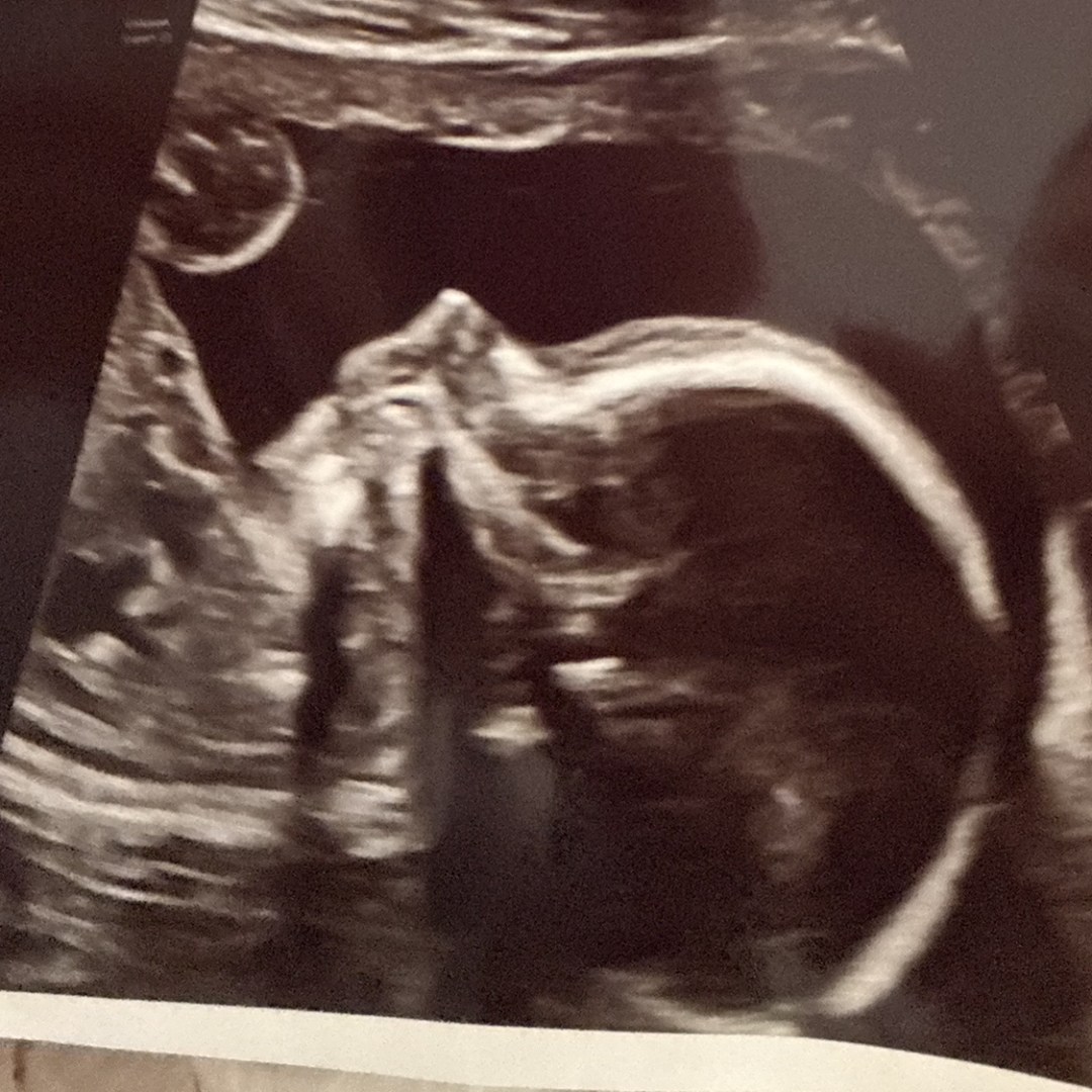 Photo shared by Jamie for their Babylist baby registry.