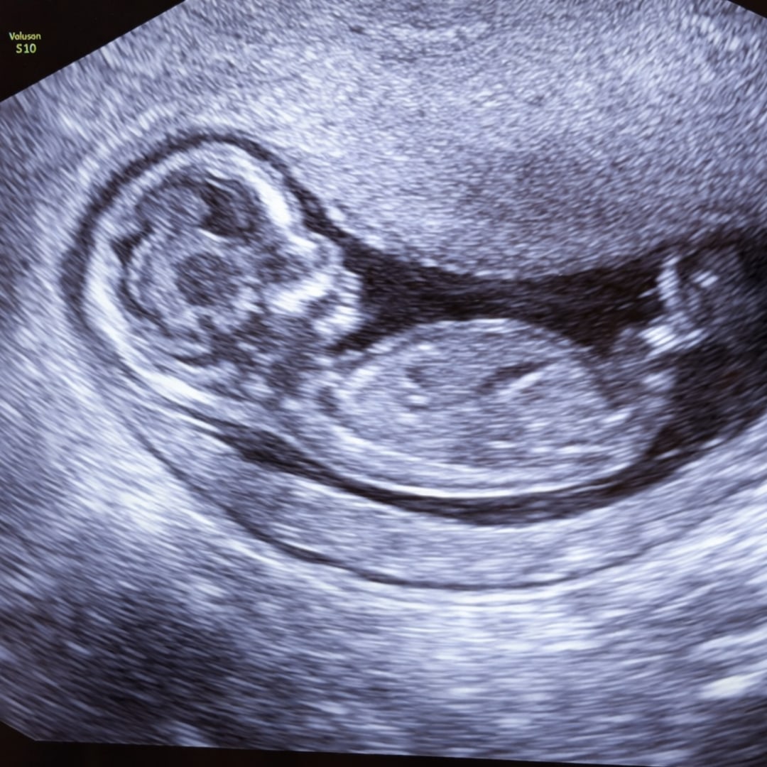 Photo shared by Crystal for their Babylist baby registry.