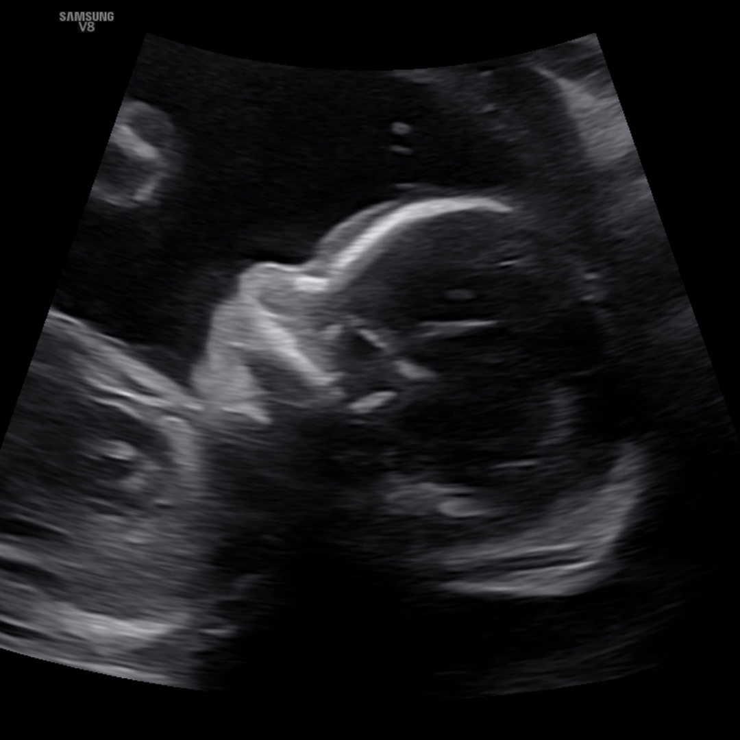 Photo shared by Abigail for their Babylist baby registry.