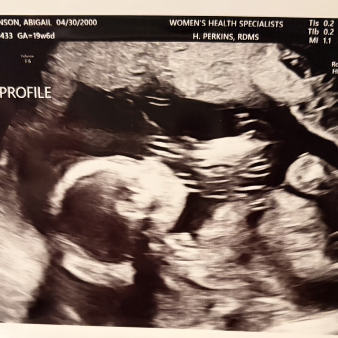 Photo shared by Abbey for their Babylist baby registry.