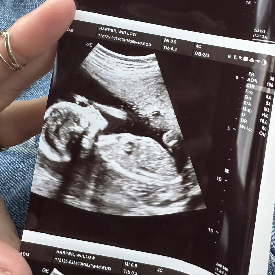 Photo shared by Willow for their Babylist baby registry.