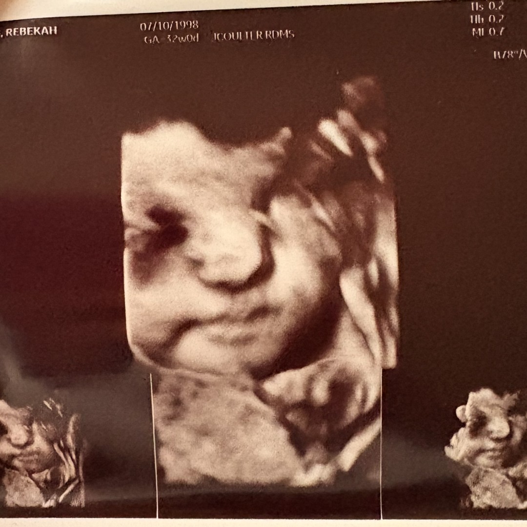 Photo shared by Rebekah for their Babylist baby registry.