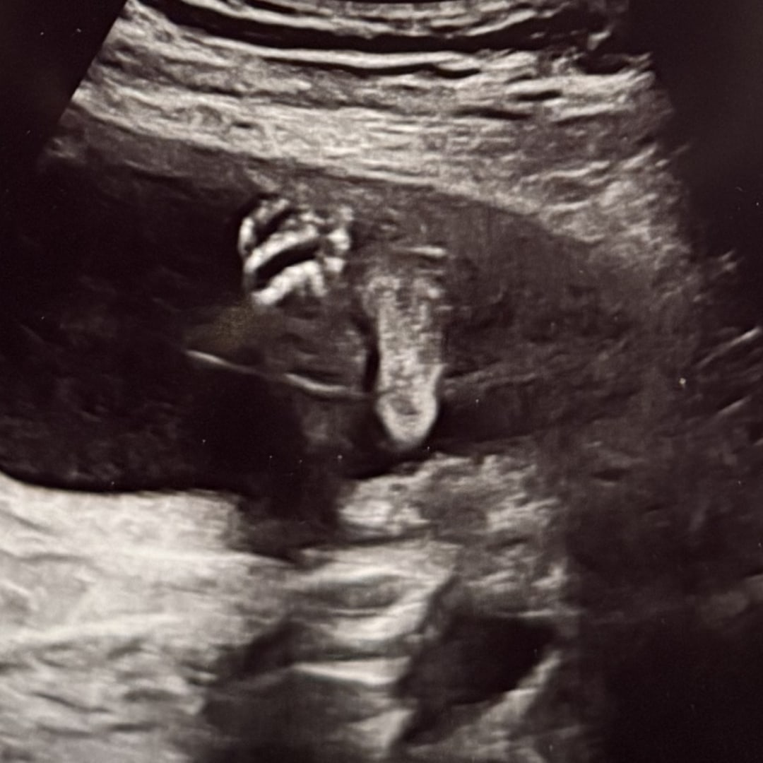 Photo shared by Alayna for their Babylist baby registry.