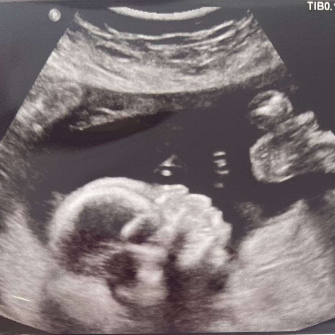 Photo shared by Jonathan for their Babylist baby registry.