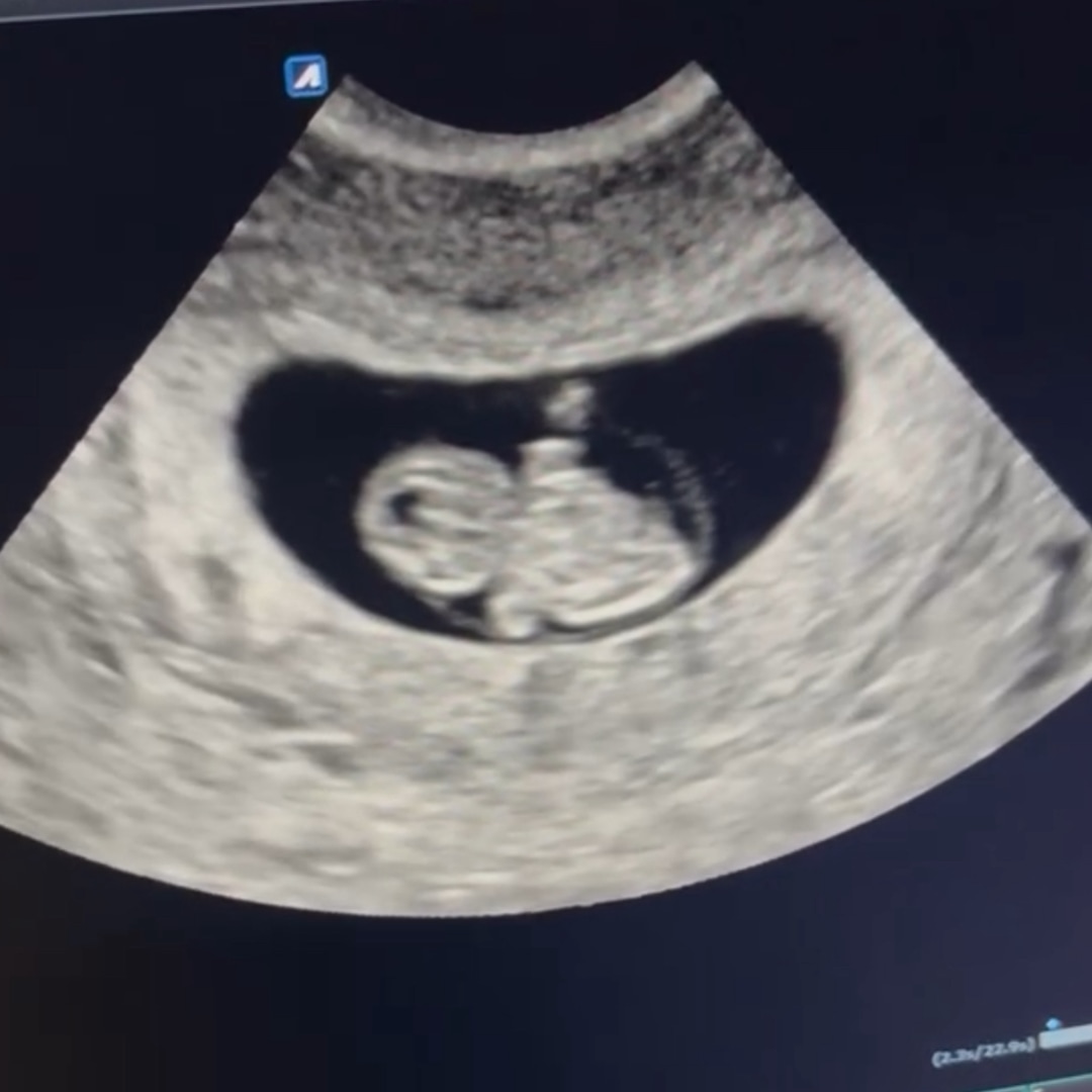 Photo shared by April for their Babylist baby registry.