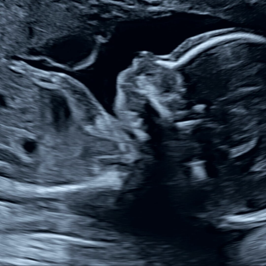 Photo shared by Ellie for their Babylist baby registry.