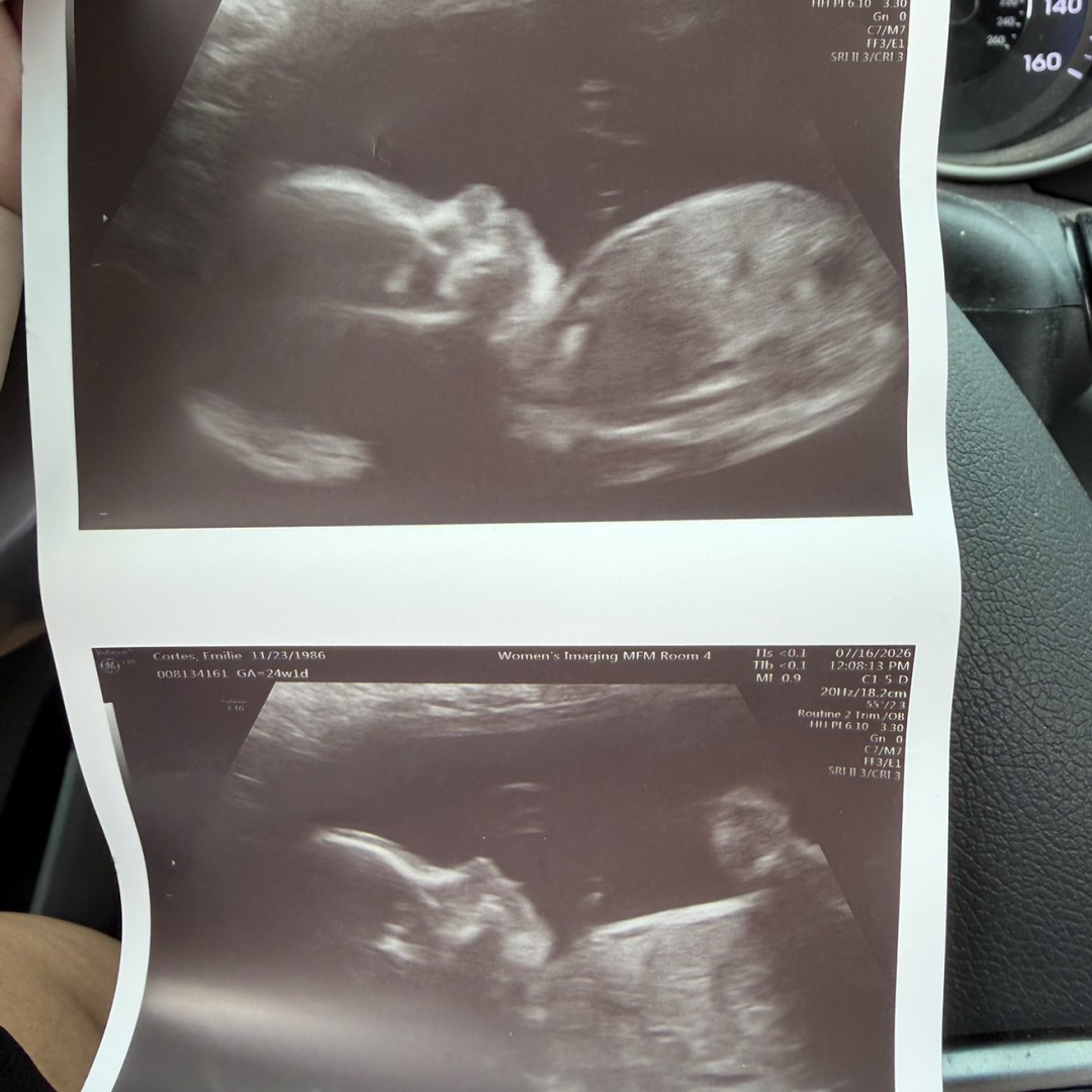 Photo shared by Emilie for their Babylist baby registry.