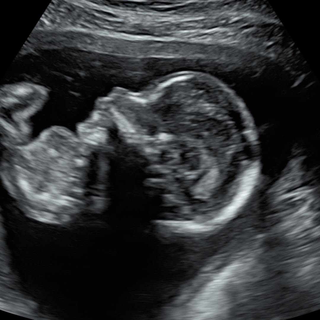 Photo shared by Aaliyah for their Babylist baby registry.