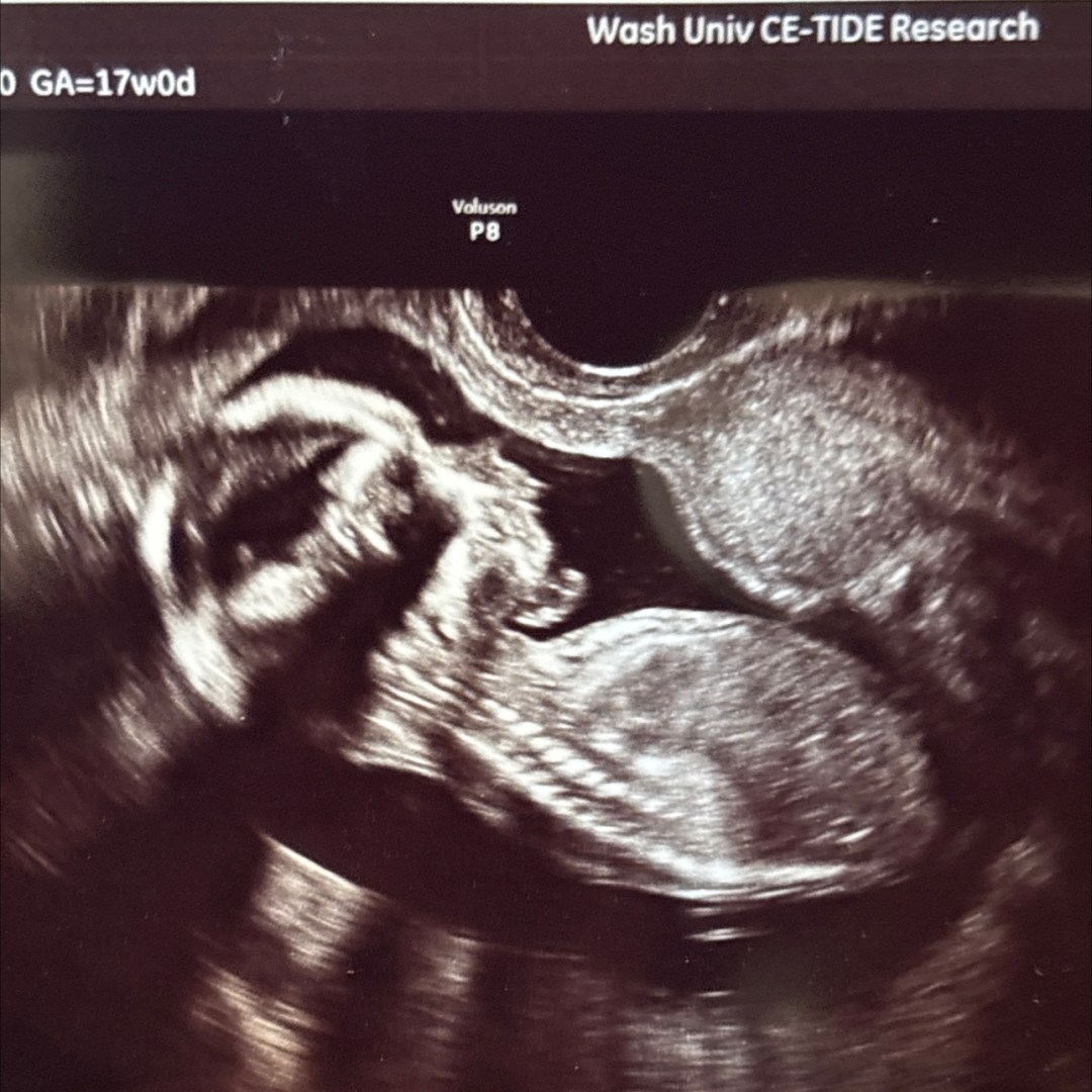 Photo shared by Molly for their Babylist baby registry.