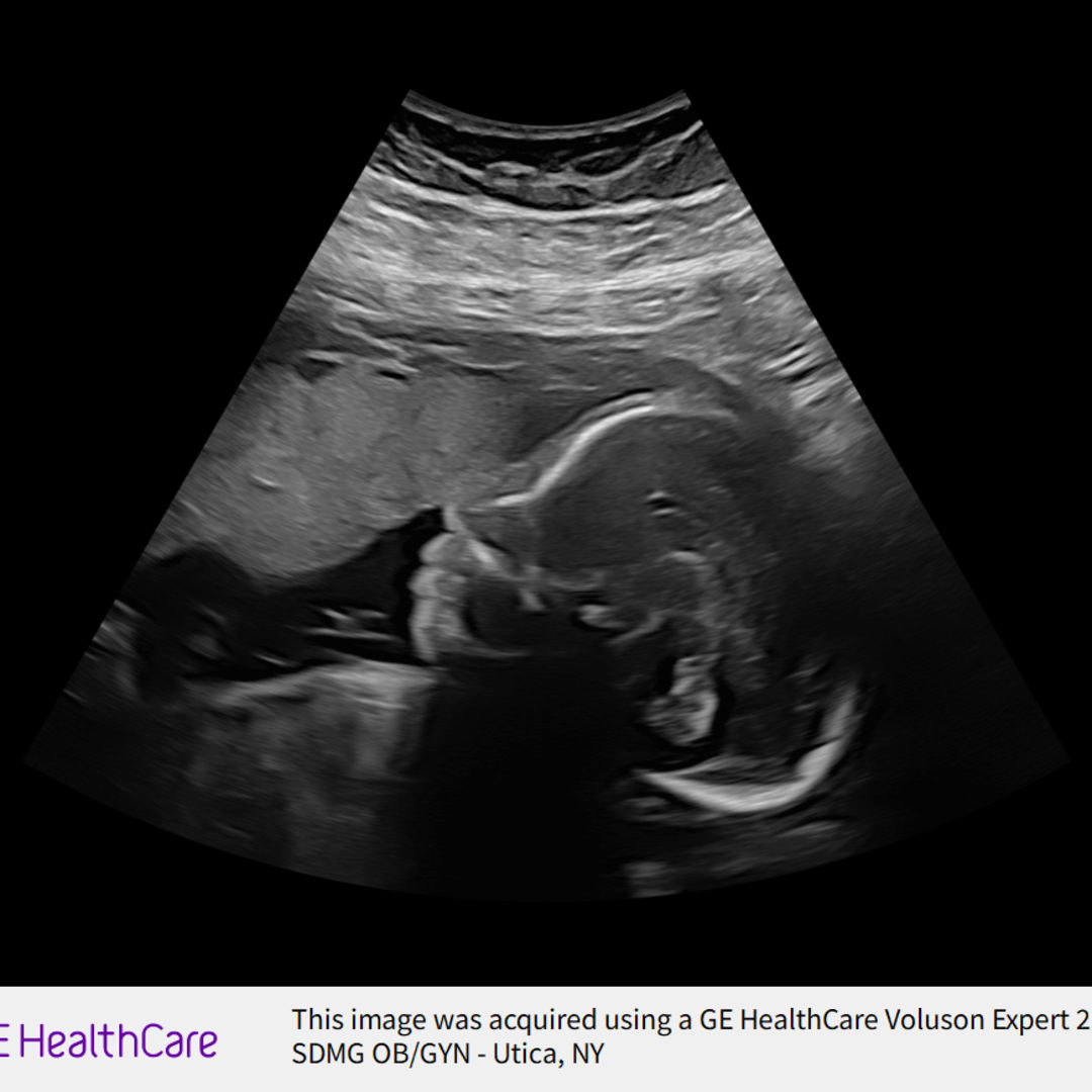 Photo shared by Payton for their Babylist baby registry.