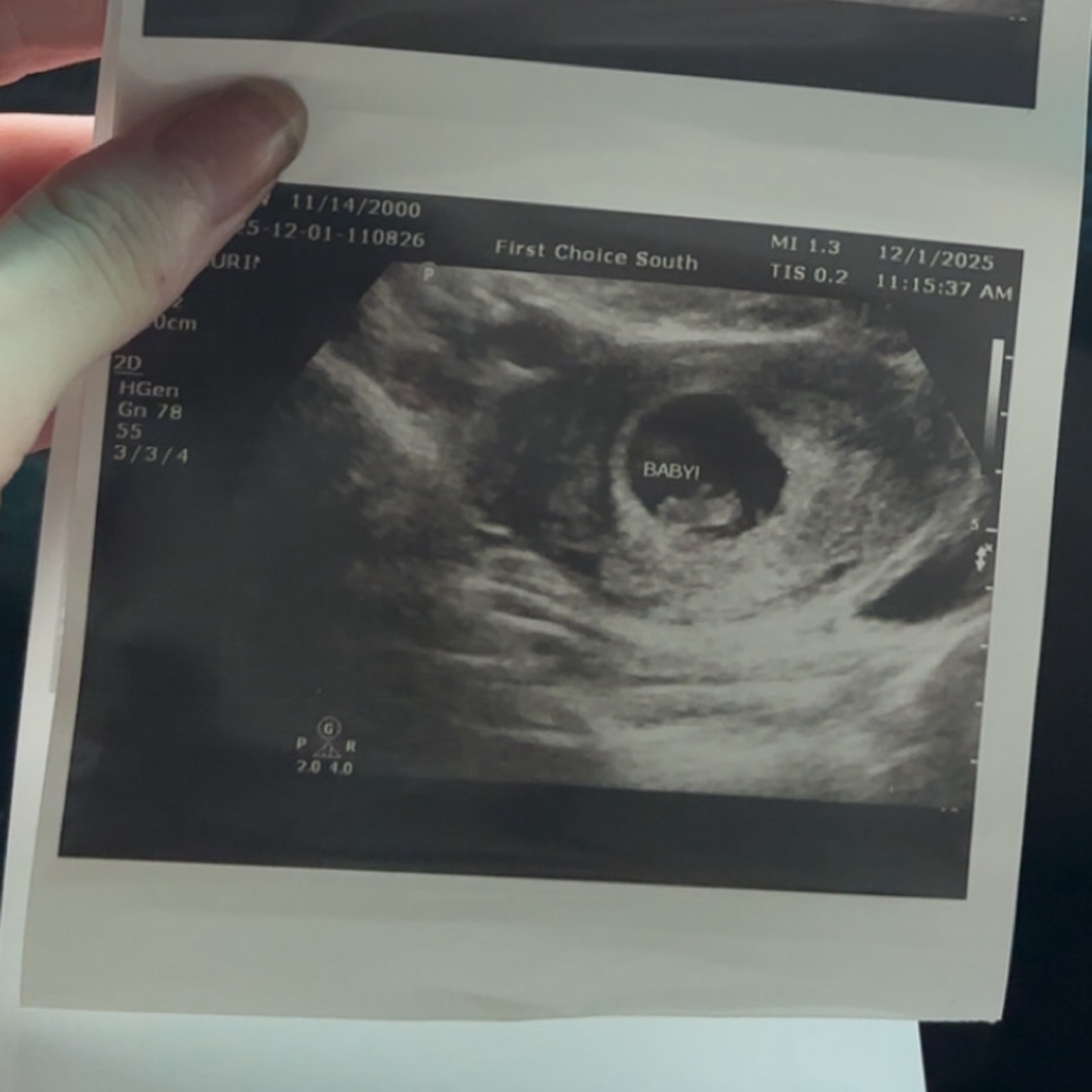 Photo shared by Payton for their Babylist baby registry.