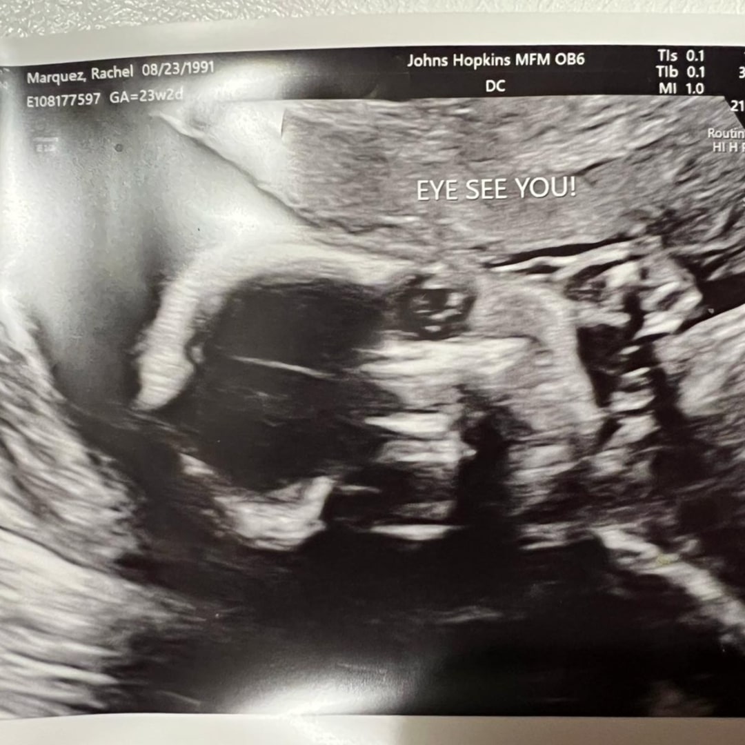 Photo shared by Rachel for their Babylist baby registry.