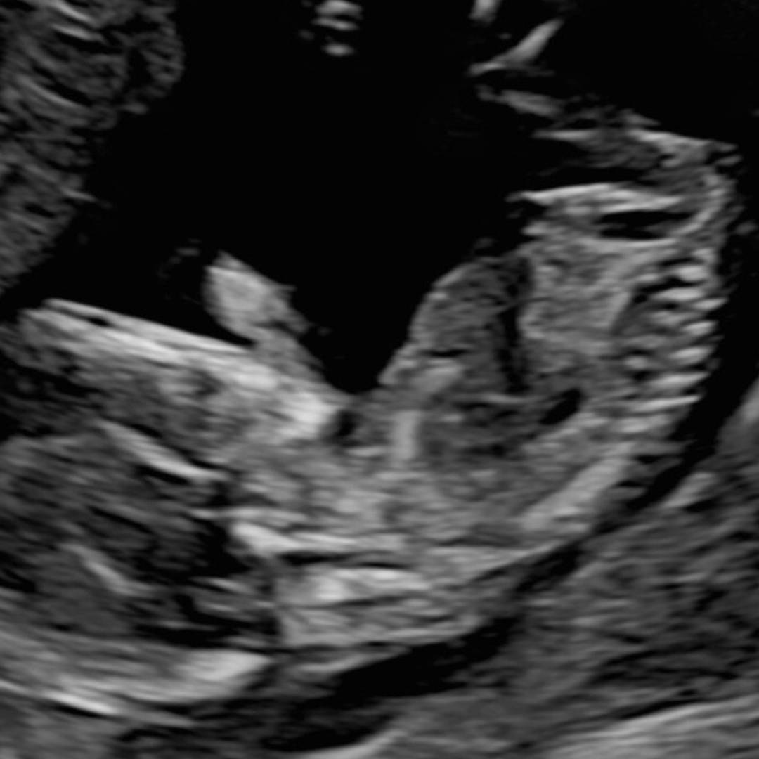 Photo shared by Alicia for their Babylist baby registry.