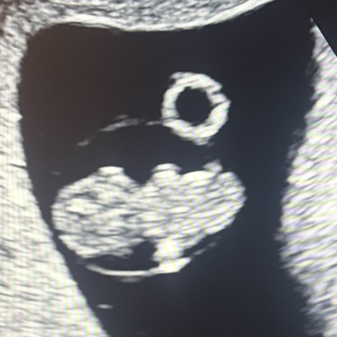 Photo shared by Emily for their Babylist baby registry.