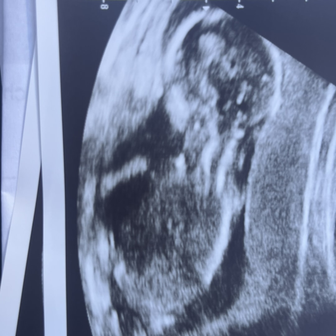 Photo shared by Payton for their Babylist baby registry.