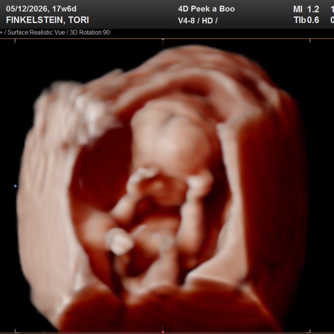 Photo shared by Tori for their Babylist baby registry.