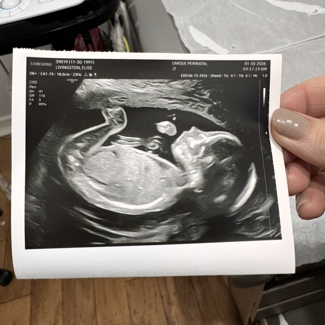 Photo shared by Elise for their Babylist baby registry.