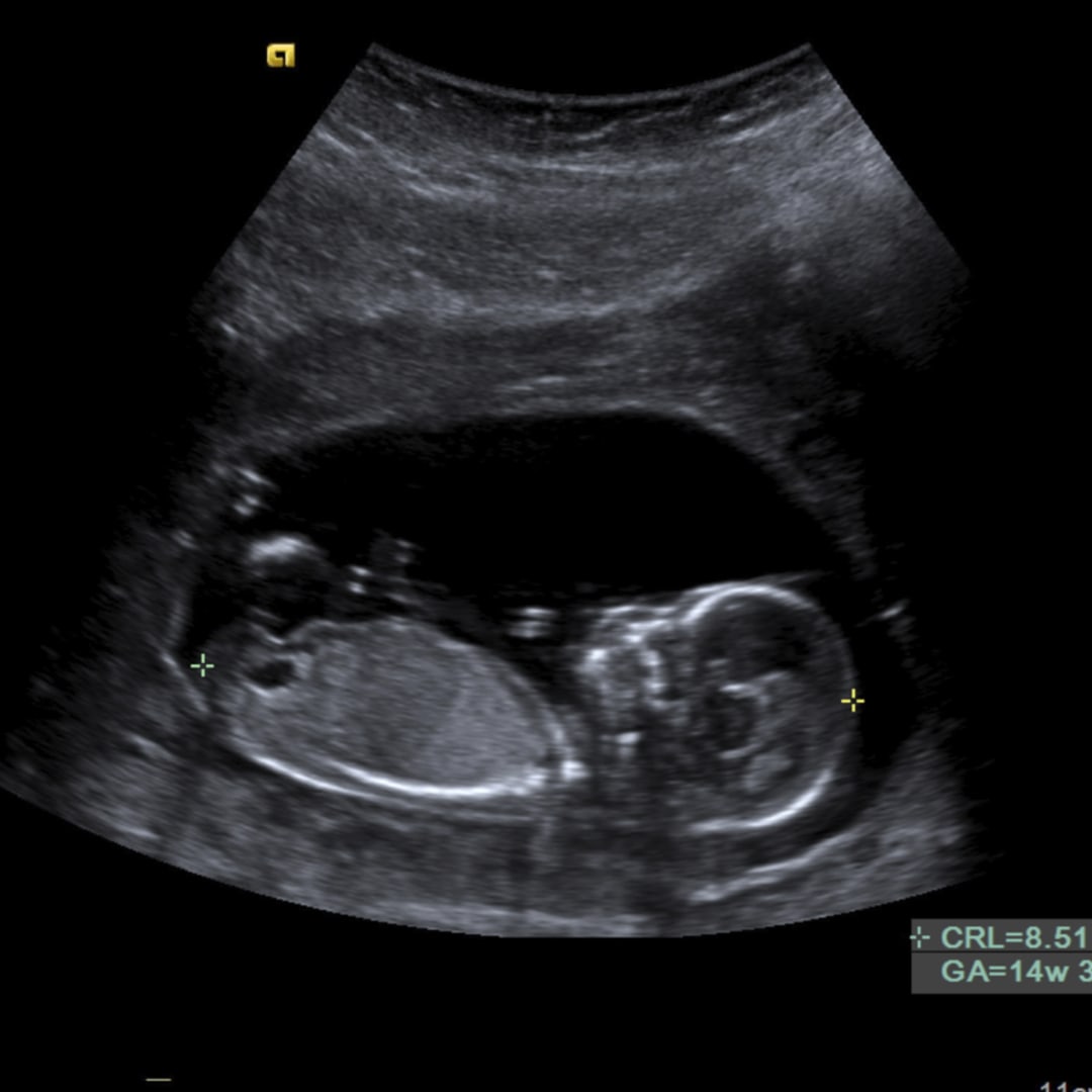 Photo shared by Celina for their Babylist baby registry.