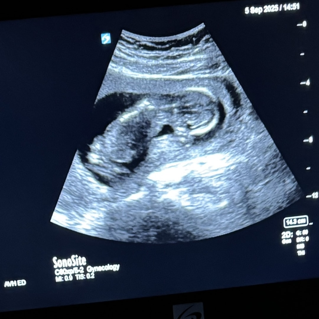 Photo shared by Kirstan for their Babylist baby registry.