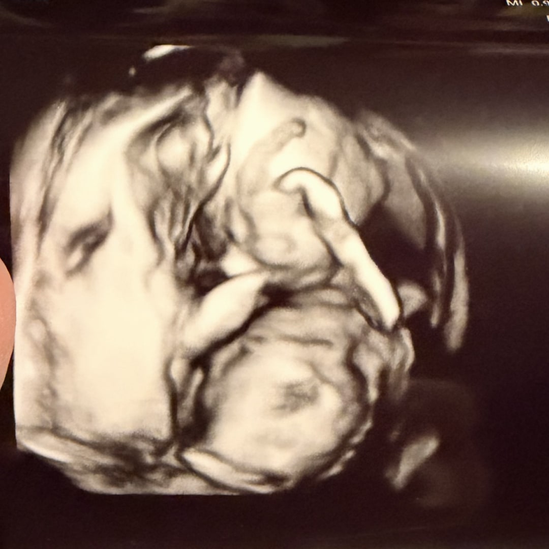 Photo shared by Raven for their Babylist baby registry.