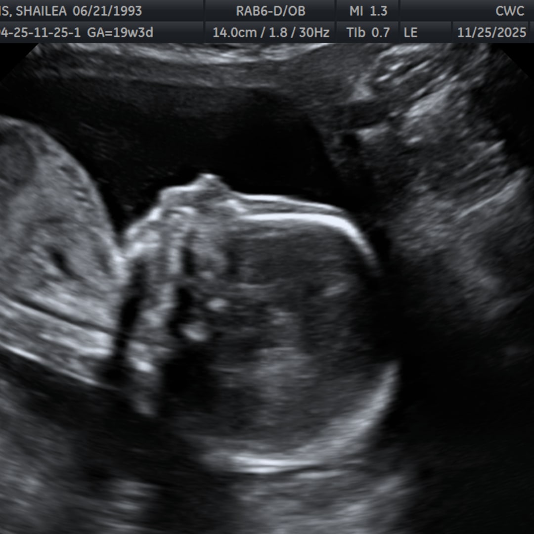 Photo shared by Shailea for their Babylist baby registry.