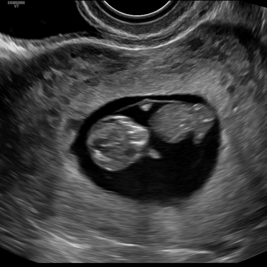 Photo shared by Amaya for their Babylist baby registry.