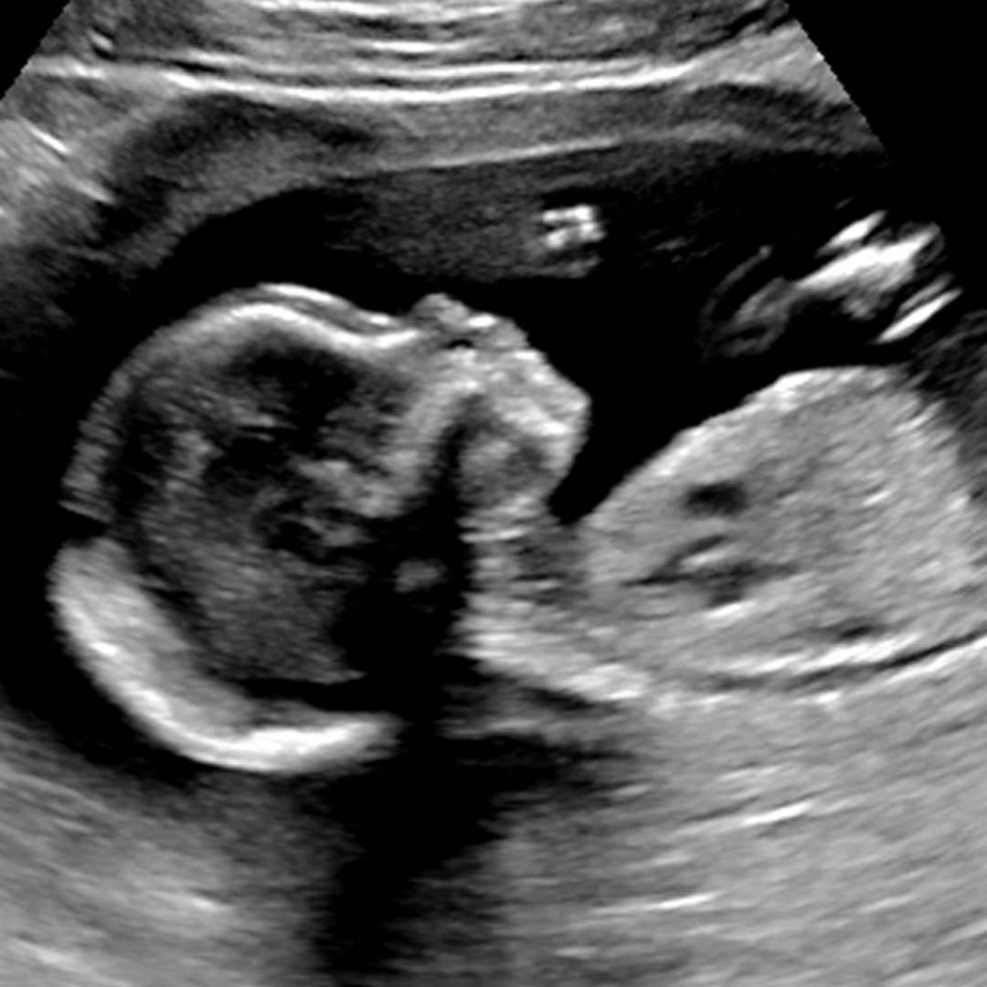 Photo shared by Korianne for their Babylist baby registry.