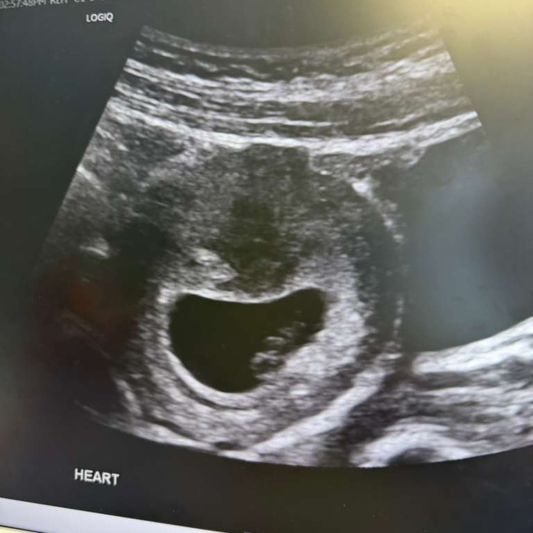 Photo shared by Ansnaylis for their Babylist baby registry.