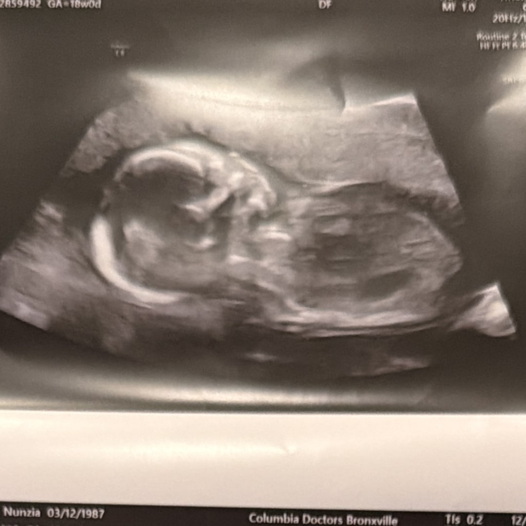 Photo shared by Nunzia for their Babylist baby registry.