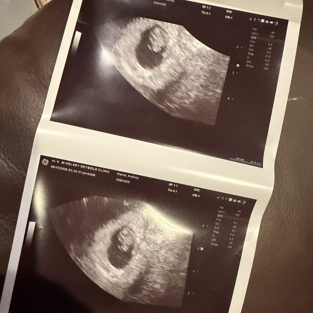 Photo shared by Aubrey for their Babylist baby registry.