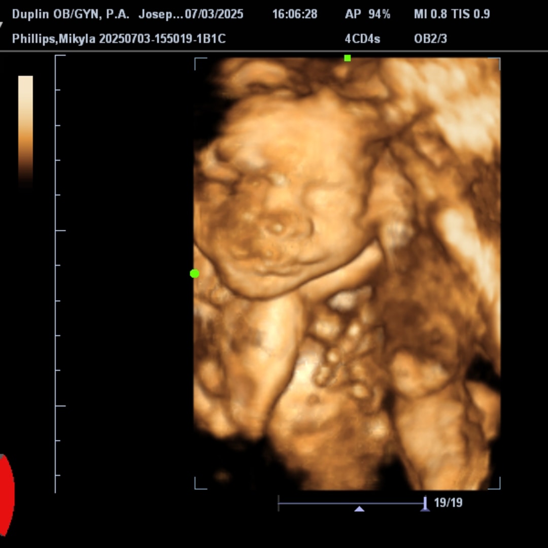 Photo shared by Mikyla for their Babylist baby registry.
