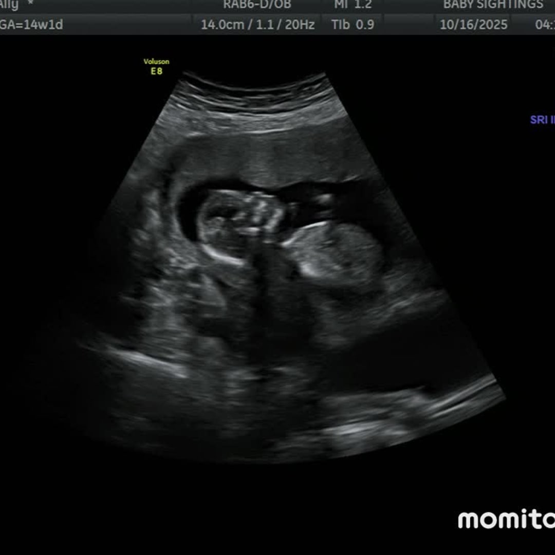 Photo shared by Ally for their Babylist baby registry.