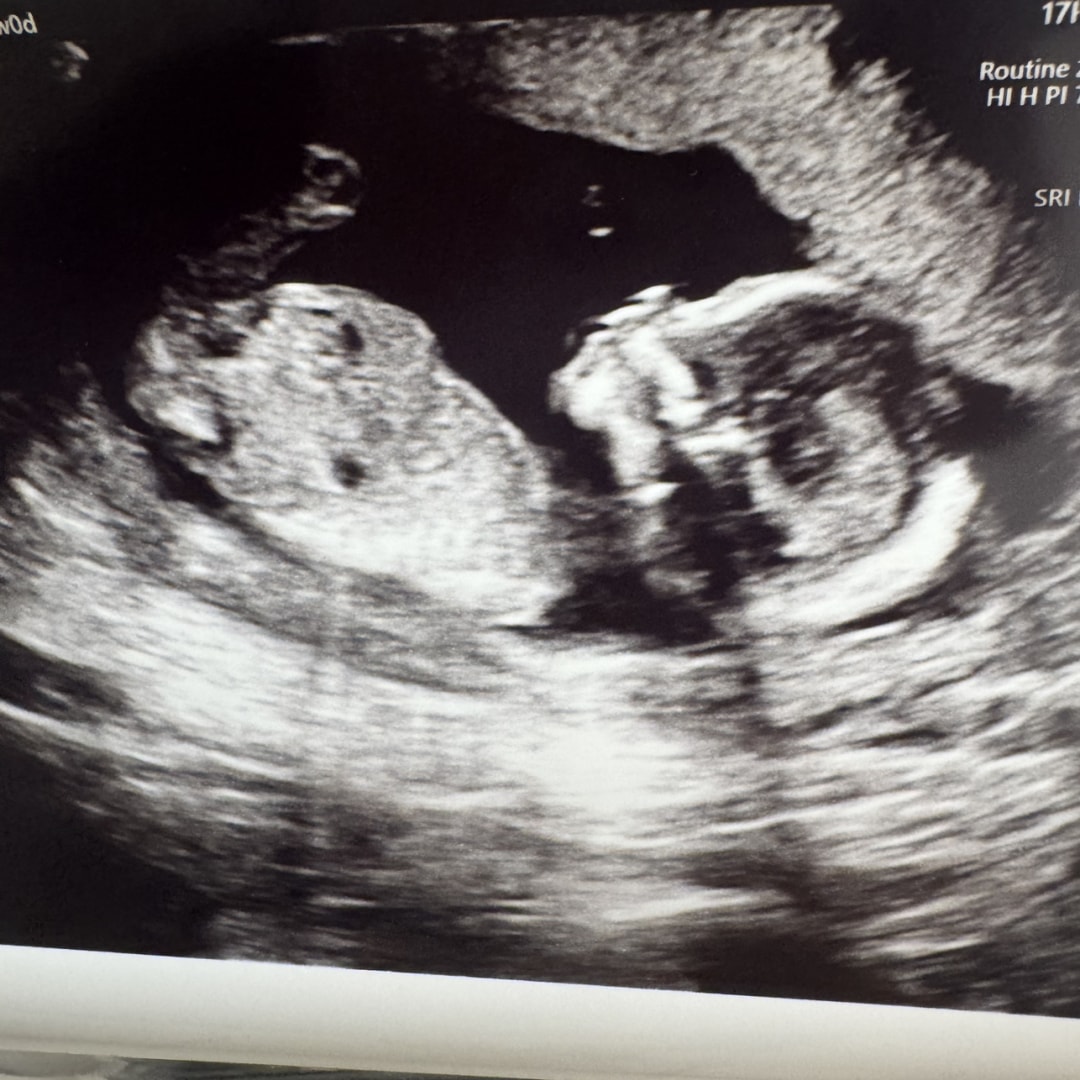 Photo shared by Ashley for their Babylist baby registry.