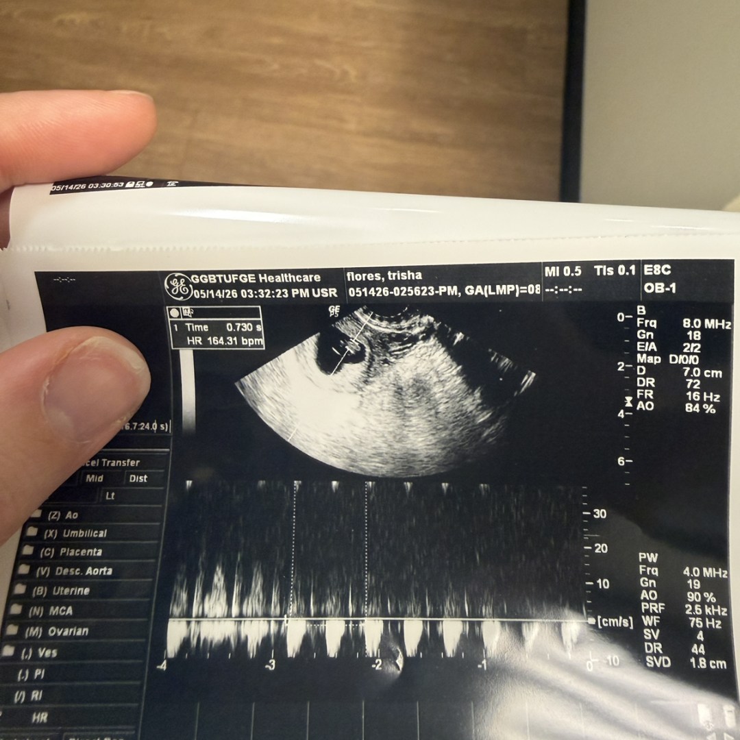 Photo shared by Trisha for their Babylist baby registry.