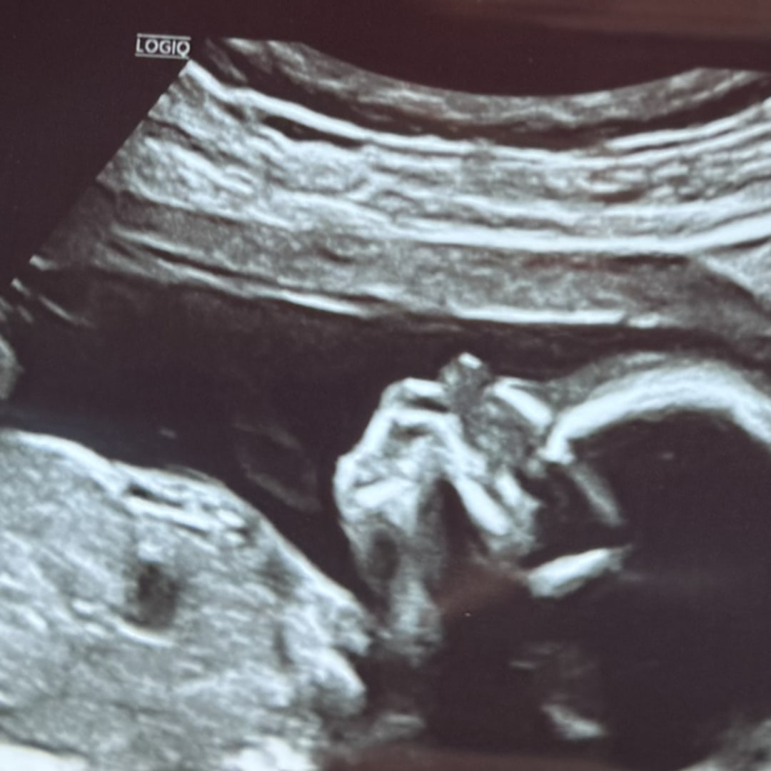 Photo shared by Viviana for their Babylist baby registry.