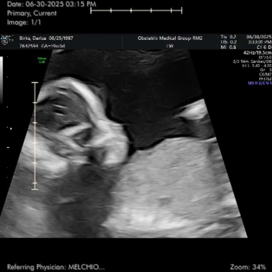 Photo shared by Derica for their Babylist baby registry.