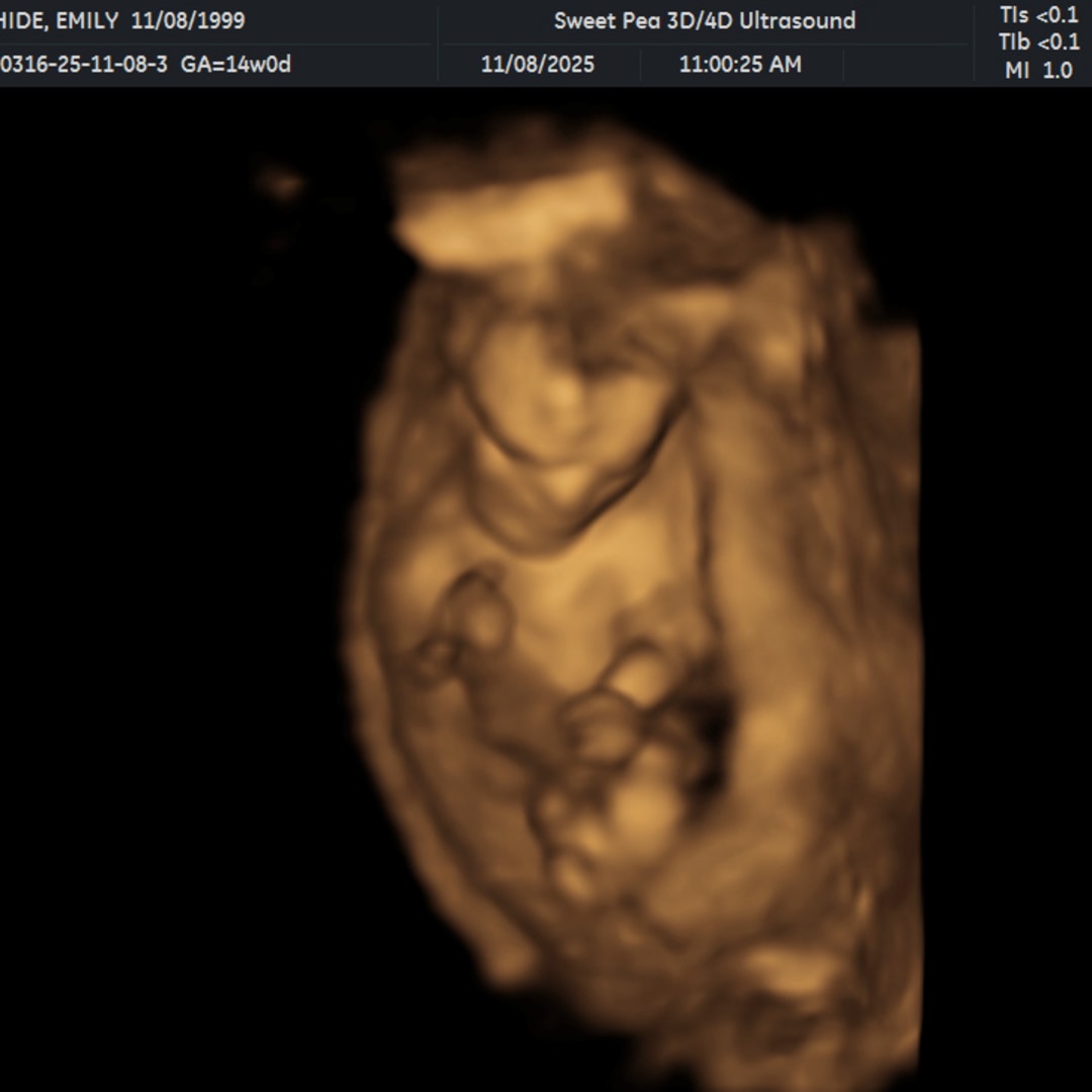 Photo shared by Emily for their Babylist baby registry.