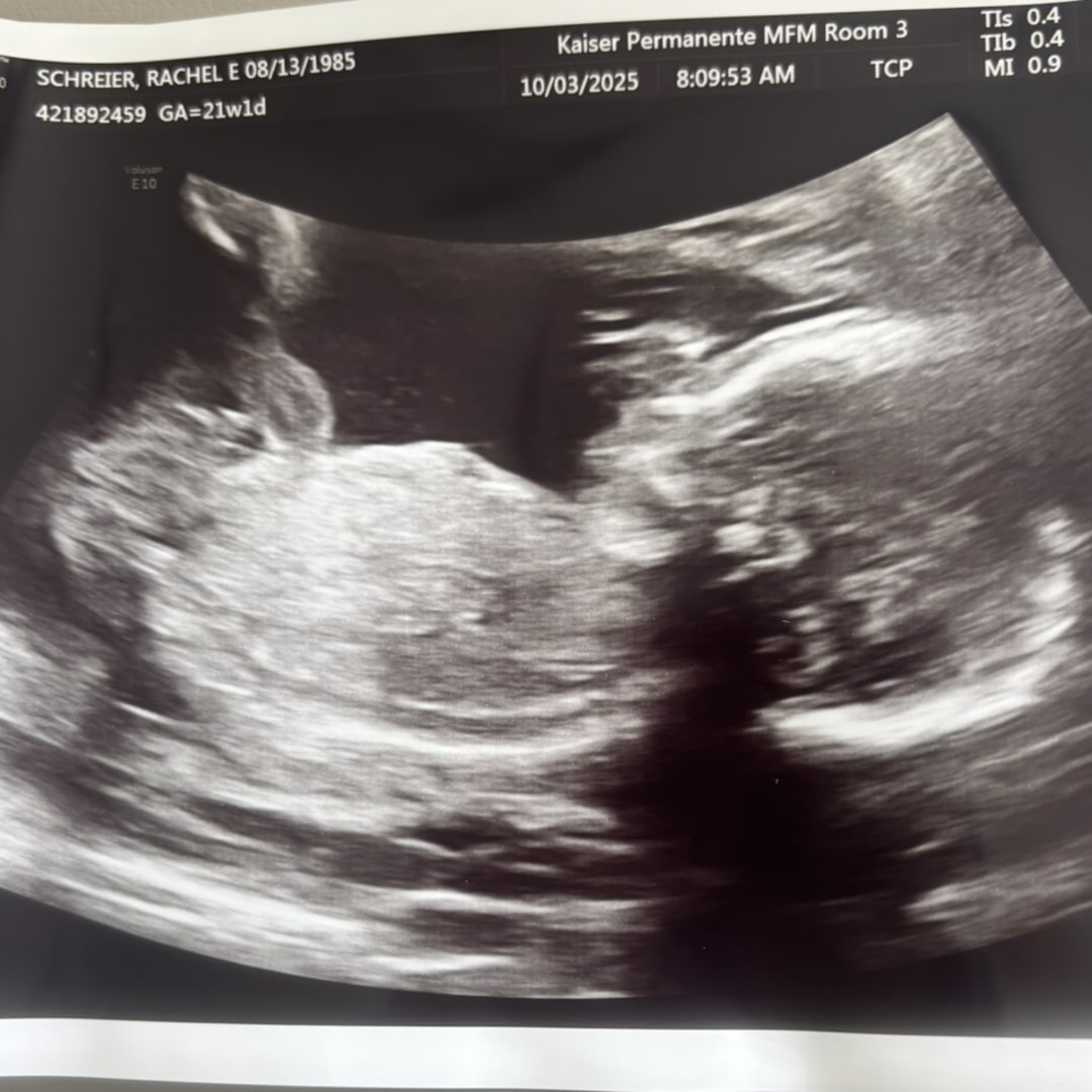 Photo shared by Rachel for their Babylist baby registry.