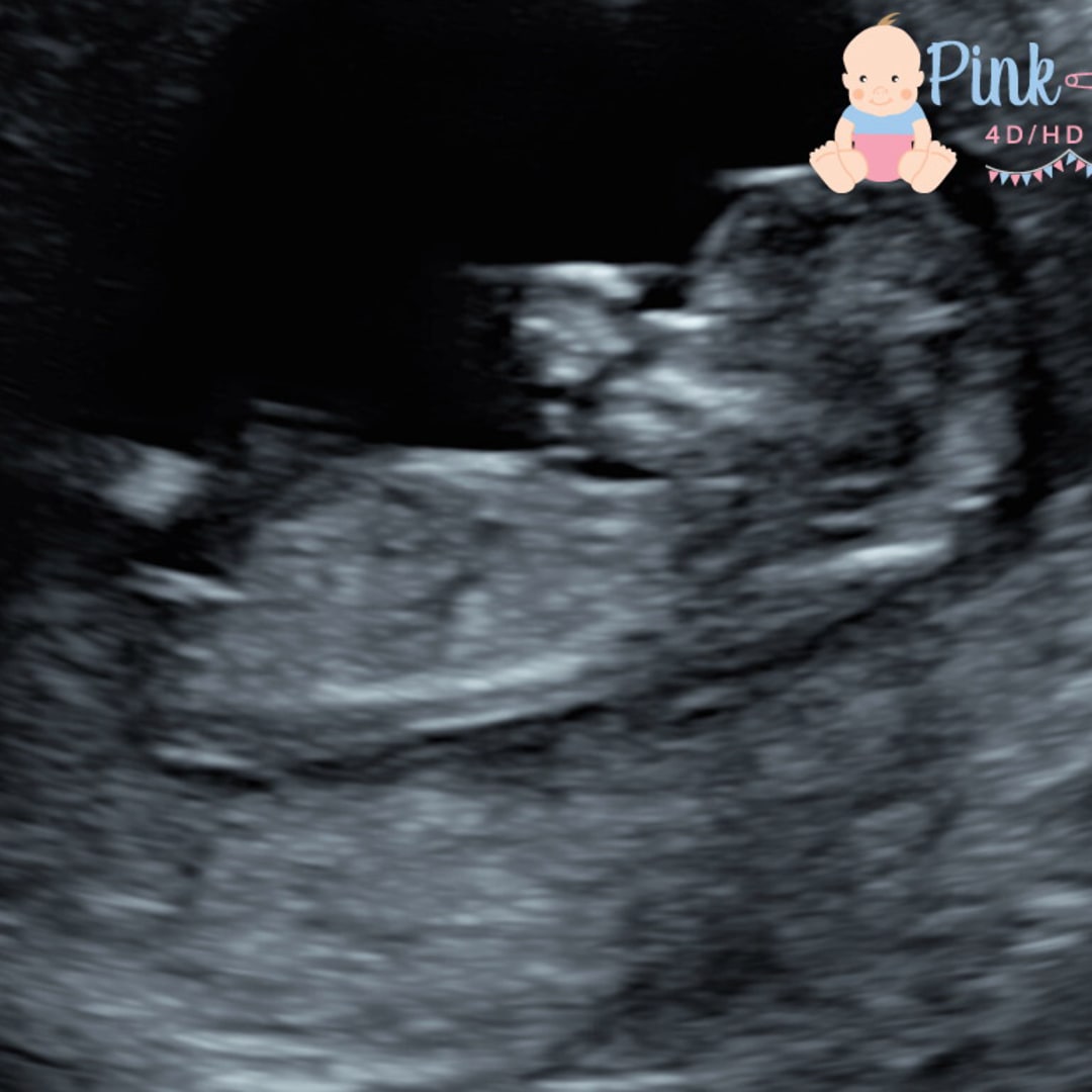 Photo shared by Khayla for their Babylist baby registry.