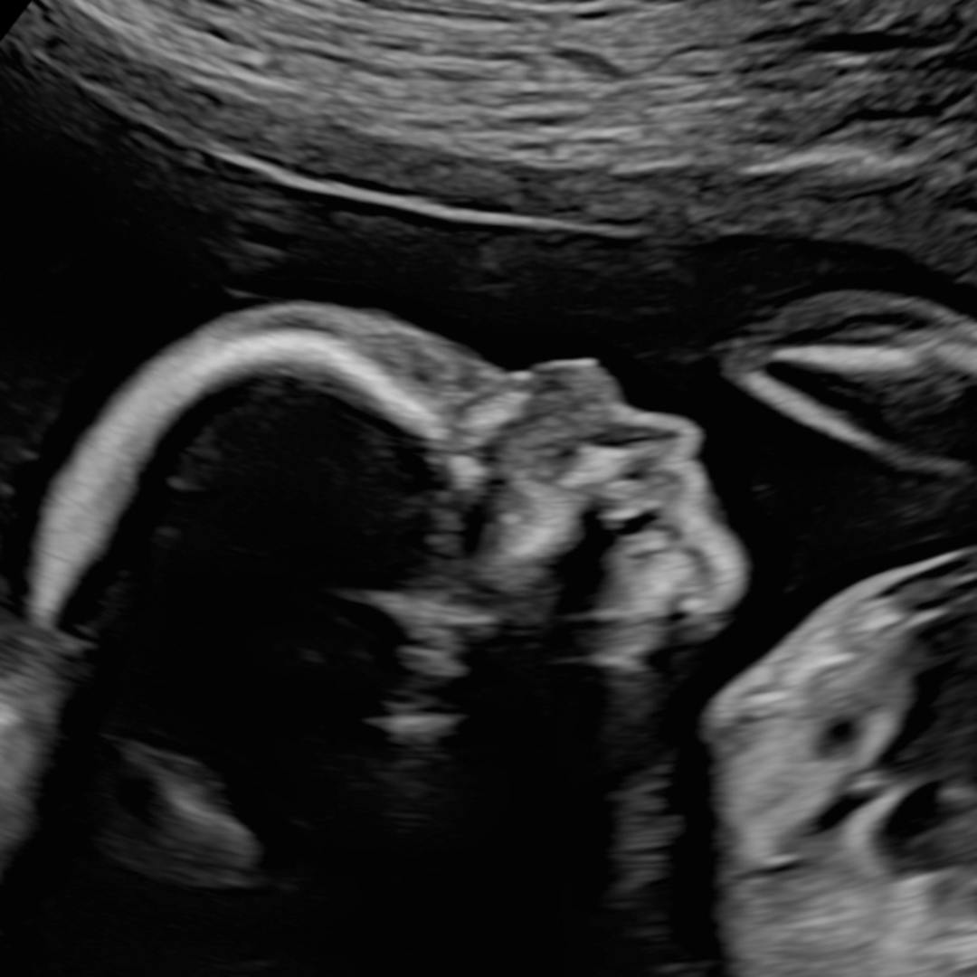 Photo shared by Kathleen for their Babylist baby registry.