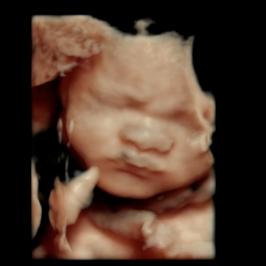 Photo shared by Jeizhelle for their Babylist baby registry.