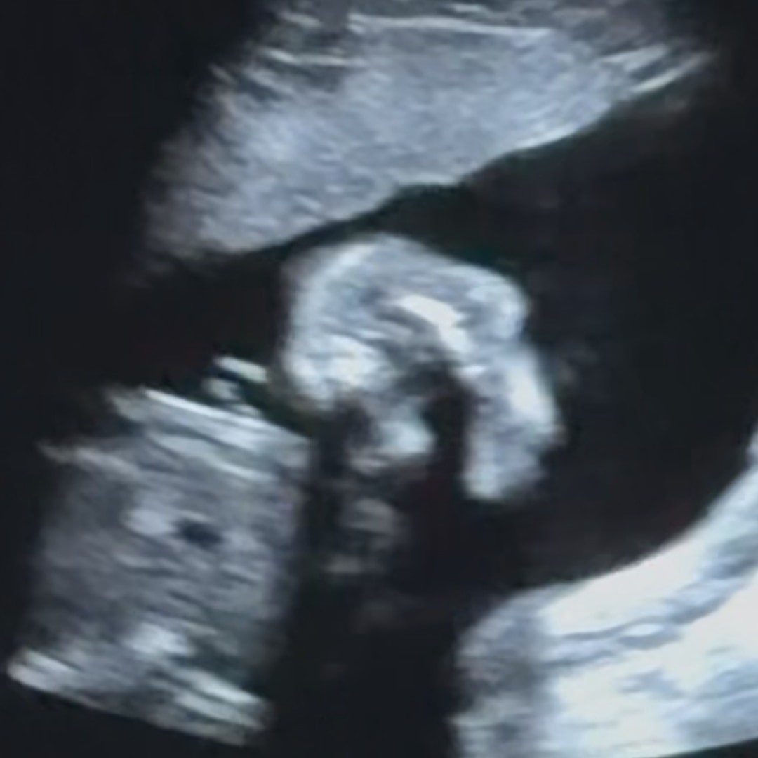 Photo shared by Keilany for their Babylist baby registry.